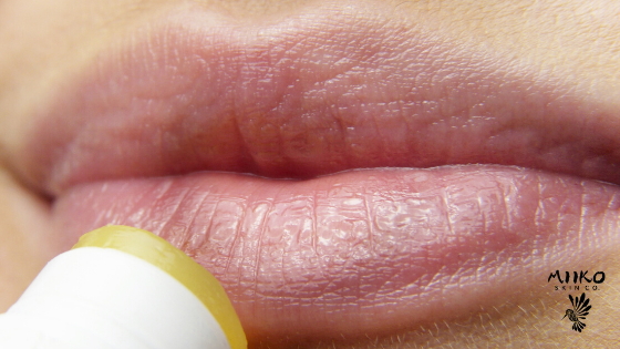 Do-it-Yourself Lip Balm Recipe